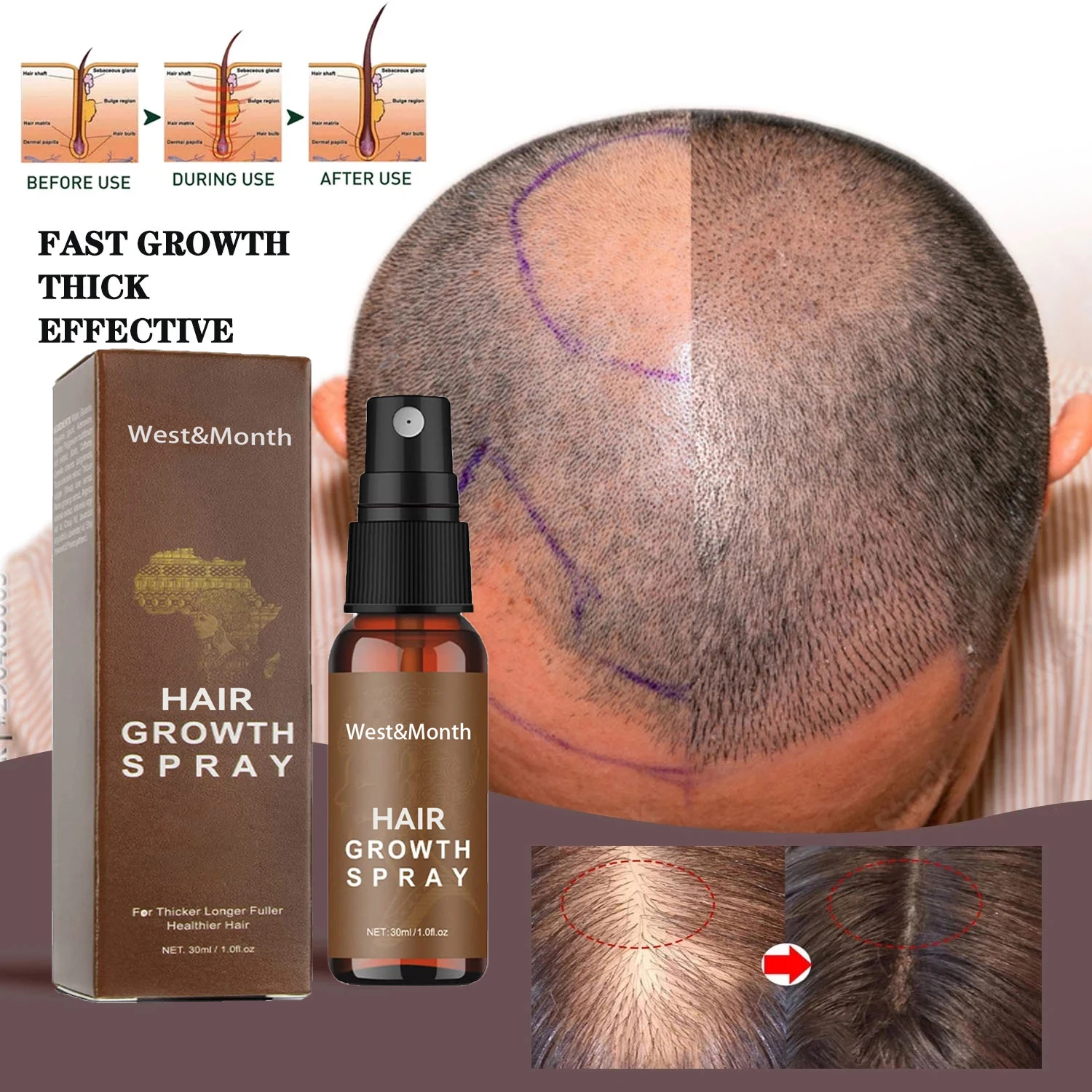 Powerful Hair Growth Serum Spray Anti Hair Loss Treatment Essence Oil