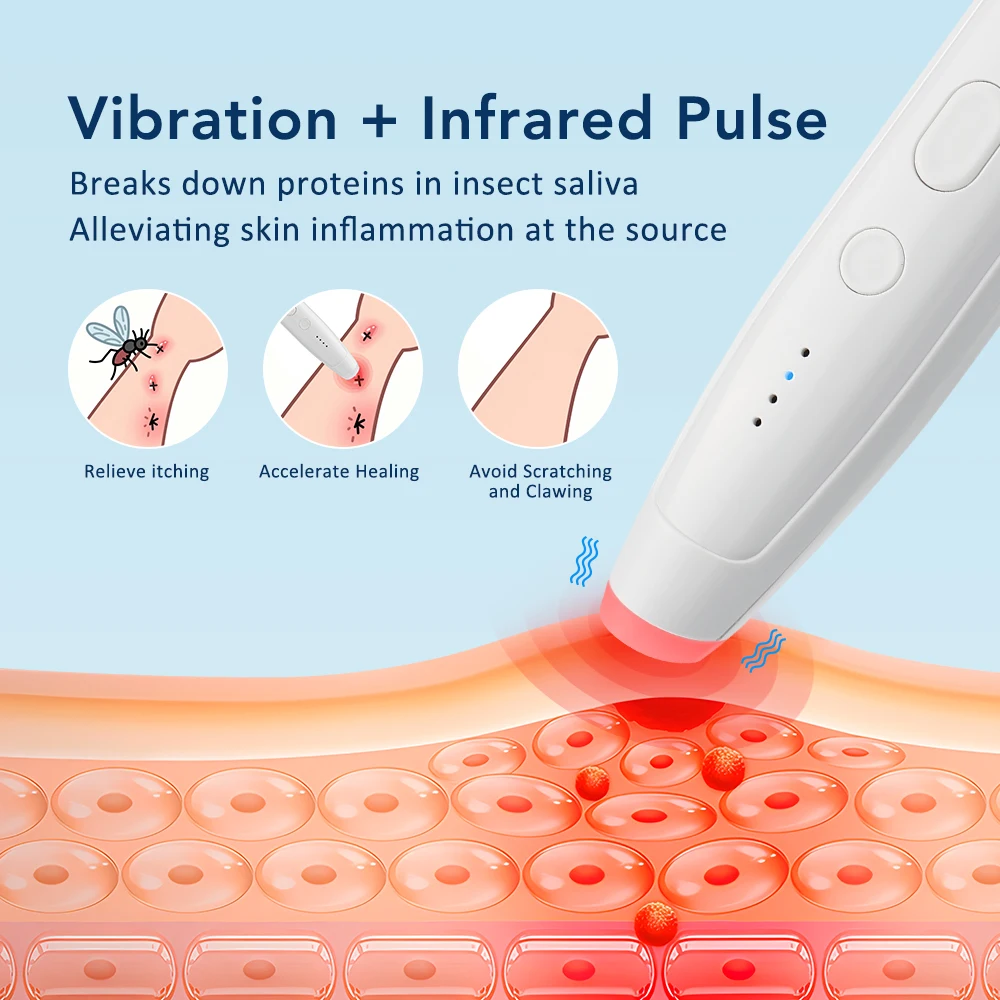 Electronic Mosquito Bite Anti-itch Device Physical Therapy 4 Gears Temperature Relieve Itching and Swelling Suitable for Outdoor