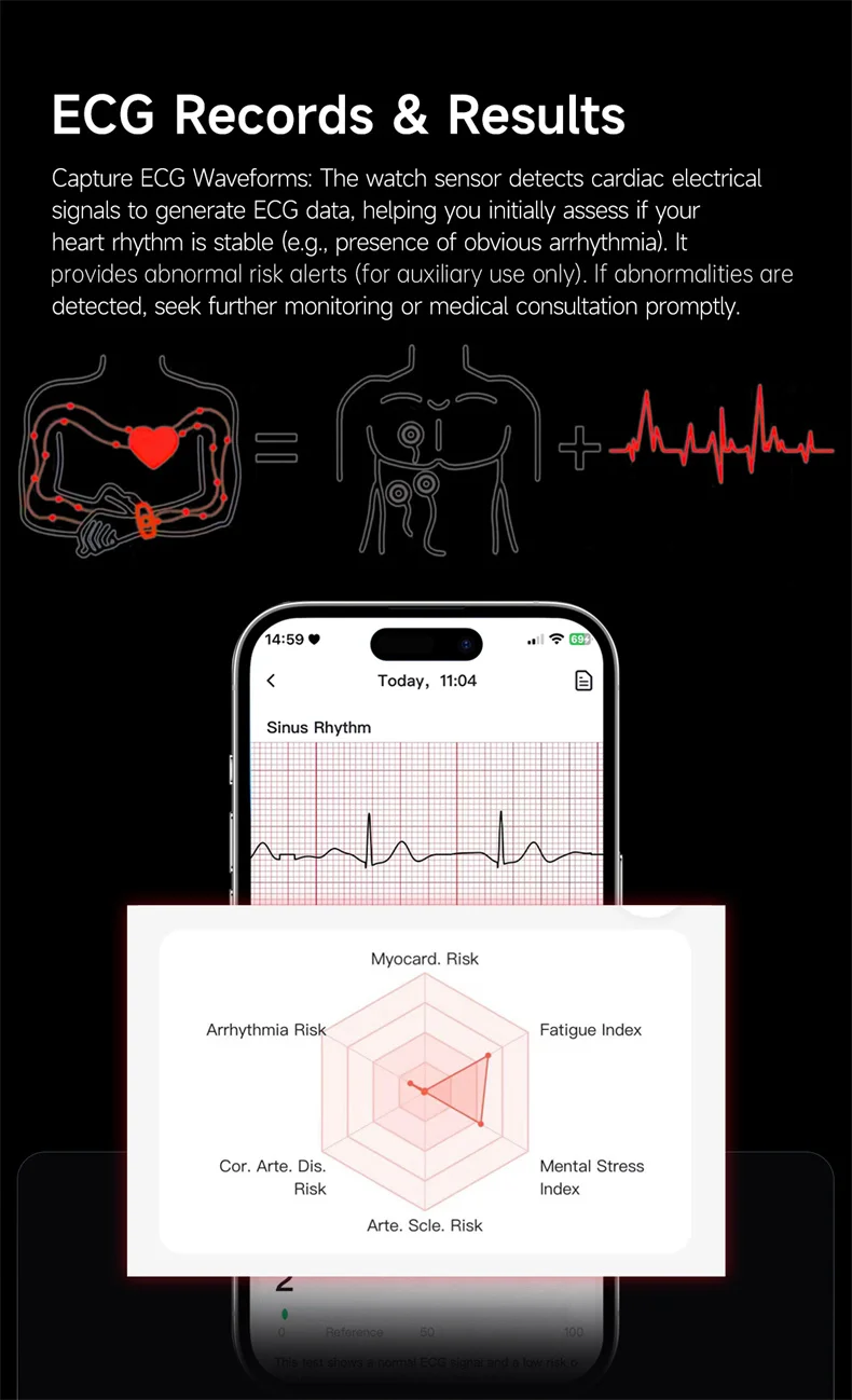 Smart Armband Mit Ekg Herzfrequenz Und Blutdruckmessgerät_voghion.com