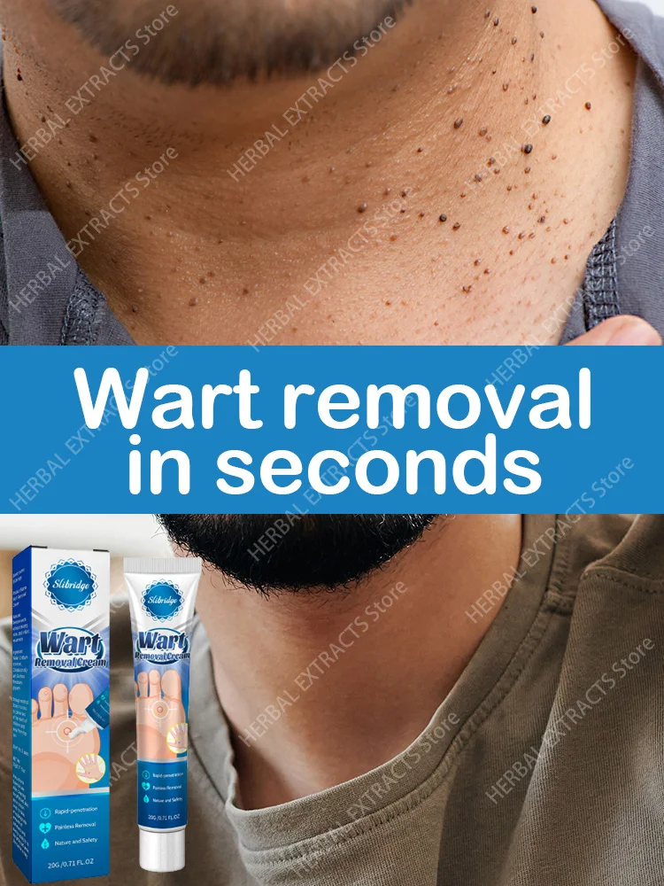 

Wart Removal Mole Remedy Papillomas Flat Wart Genitals