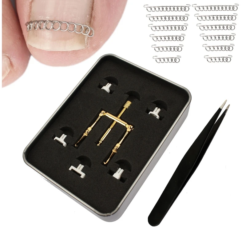 

Инструмент для вросшего ногтя Зажим для пальцев Корректор вросшего ногтя Насадки Фиксаторы для ногтей