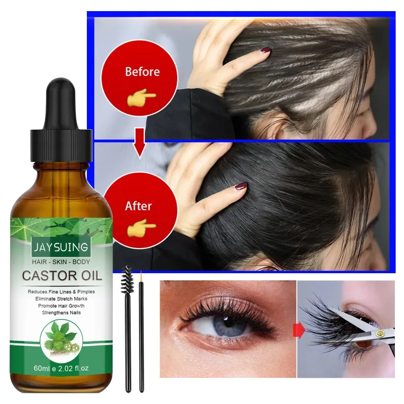 Description Picture 2 of itemHair Thickening Castor Oil for Hair Growth Treatment Preventing Baldness Anti Hair Loss Roots Shining Nourishing Enhancing Care