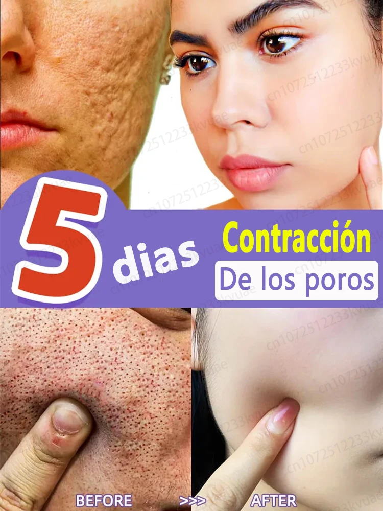 Pore shrinking serum for facial removal of large pores, firming and repair of large pores on face
