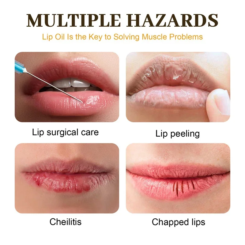 Fast Lightening Pink Mouth Lips Serum Bleaching Permanent Remove Dark Smoke Lips Lip Balm Moisturize Gloss Lipstick Lip Mask 4