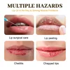 Fast Lightening Pink Mouth Lips Serum Bleaching Permanent Remove Dark Smoke Lips Lip Balm Moisturize Gloss Lipstick Lip Mask 4