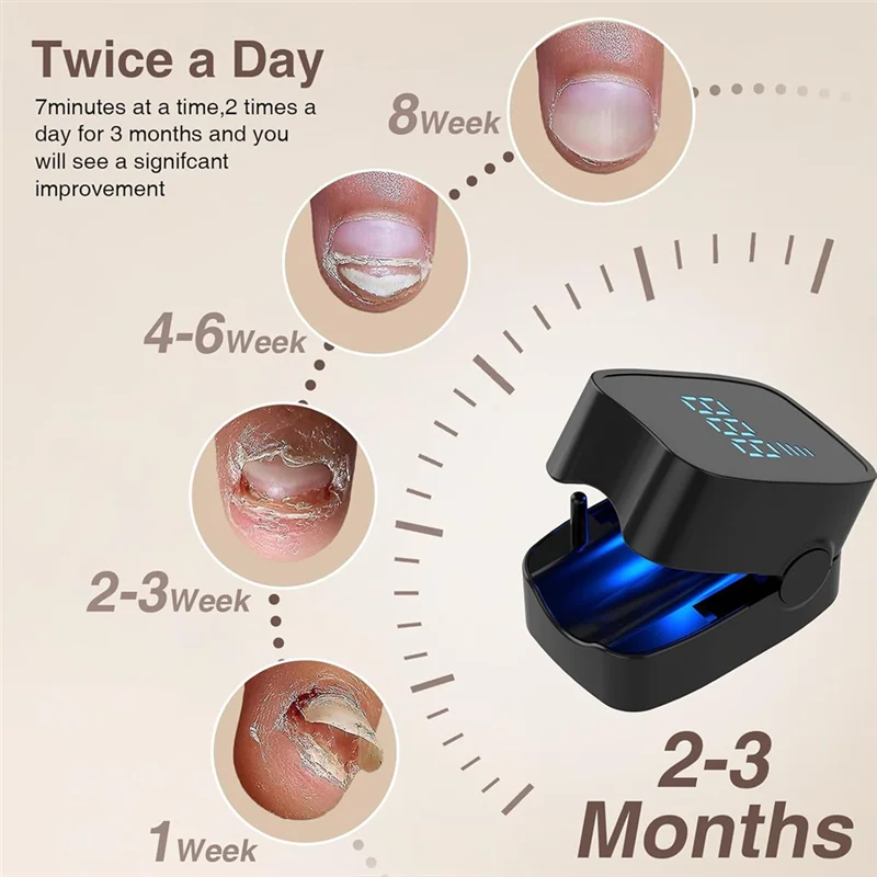 Dispositivo per il trattamento dei funghi delle unghie 905Nm a infrarossi e 470Nm LED blu con luce laser-terapia per onicomicosi - immagine 5