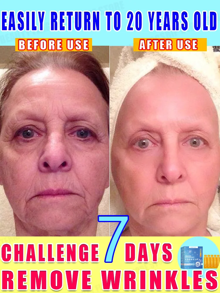 Rapid anti-wrinkle and anti-aging essence facial brightening, firming, rejuvenating, moisturizing and repairing essence