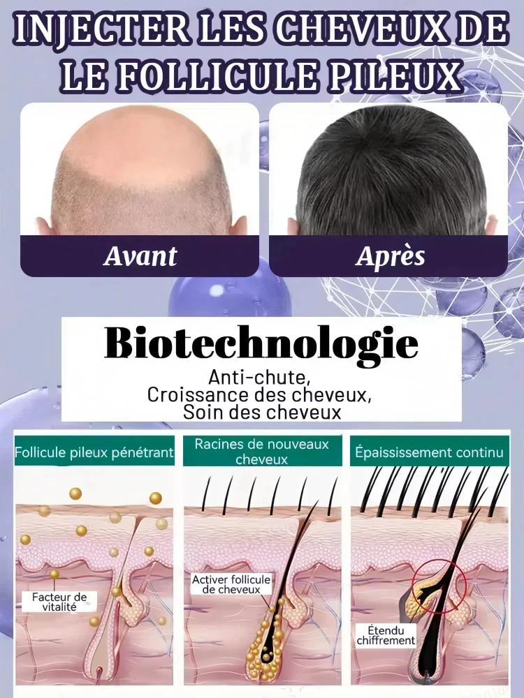 Revive Hair Strong Penetration Activate Hair Roots More Hair Say Goodbye to Baldness Thick Hair hair growth serum hair building powder hair building fibers hair growth spray hair growth cream hair growth shampoo set