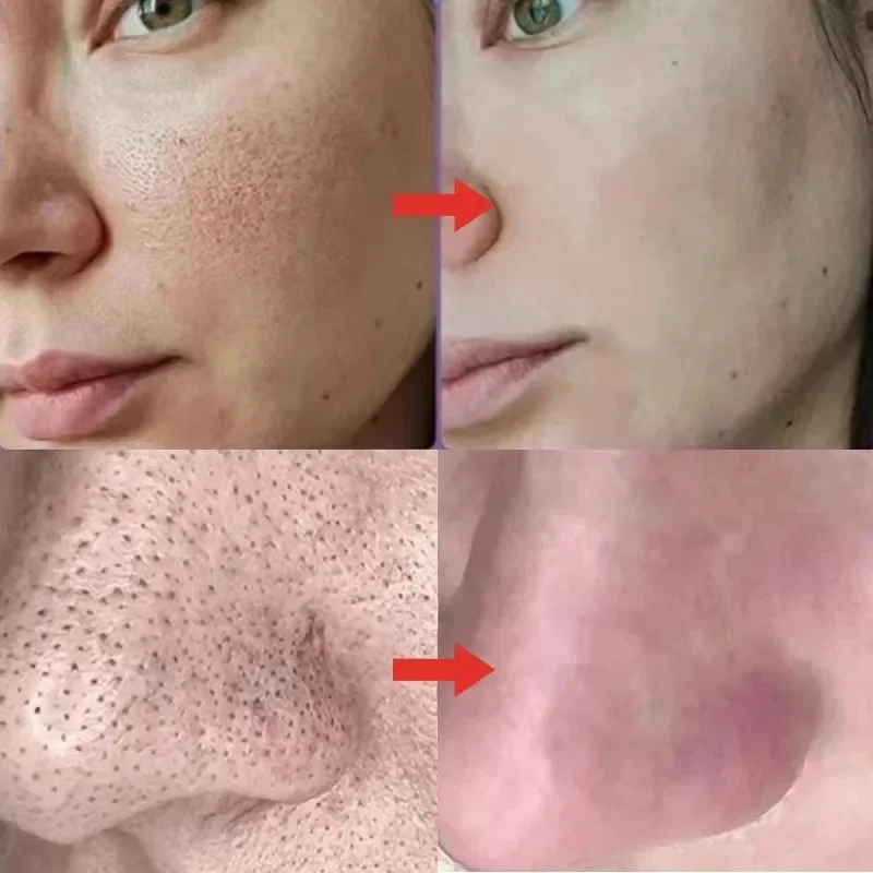 Facial Serum Facial Essence Retinol Face Serum Salicylic Acid Facial Serum