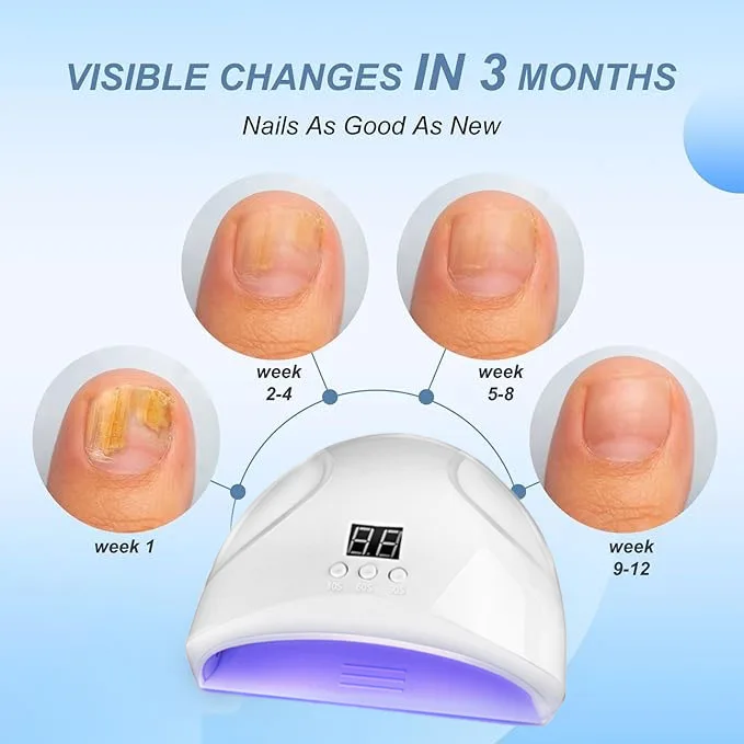 Nail Laser Fungal Nail Device Toenail Fingernail Fungus Treat Onychomycosis Essence Oil Removes Foot Care