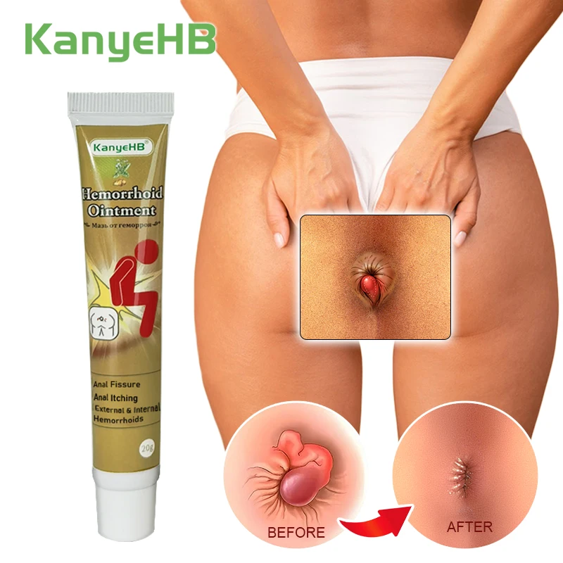 1pcs Medical Hemorrhoid Cream External & Internal Hemorrhoids Piles Swelling Pain Relief Cream Anal Bleeding Repair Anus G003 pain relief cream hemorrhoids treatment cream