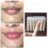 Dark Lip Lightening Product ,Lip Bleaching, Whitening Lips to Pink Smokers too 1