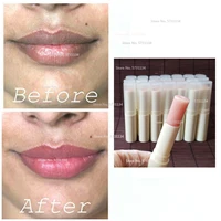 Dark Lip Lightening Product ,Lip Bleaching, Whitening Lips to Pink Smokers too 1