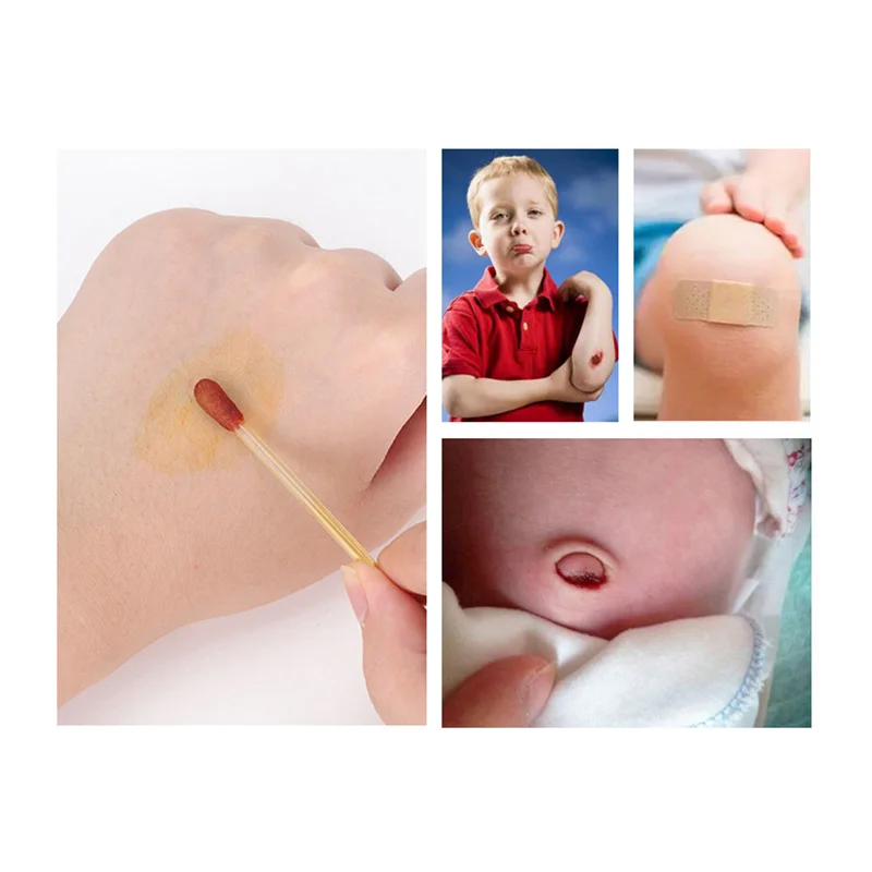 30pcs disposable broken disinfectant sterile iodine swab for infants and young children, medical alcohol iodine swab