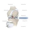 Interventional Materials for Orthopedc Surgery Well Design Arthrex Inside-out Meniscal Repair Suture Needles Fast Fix Depuy 3