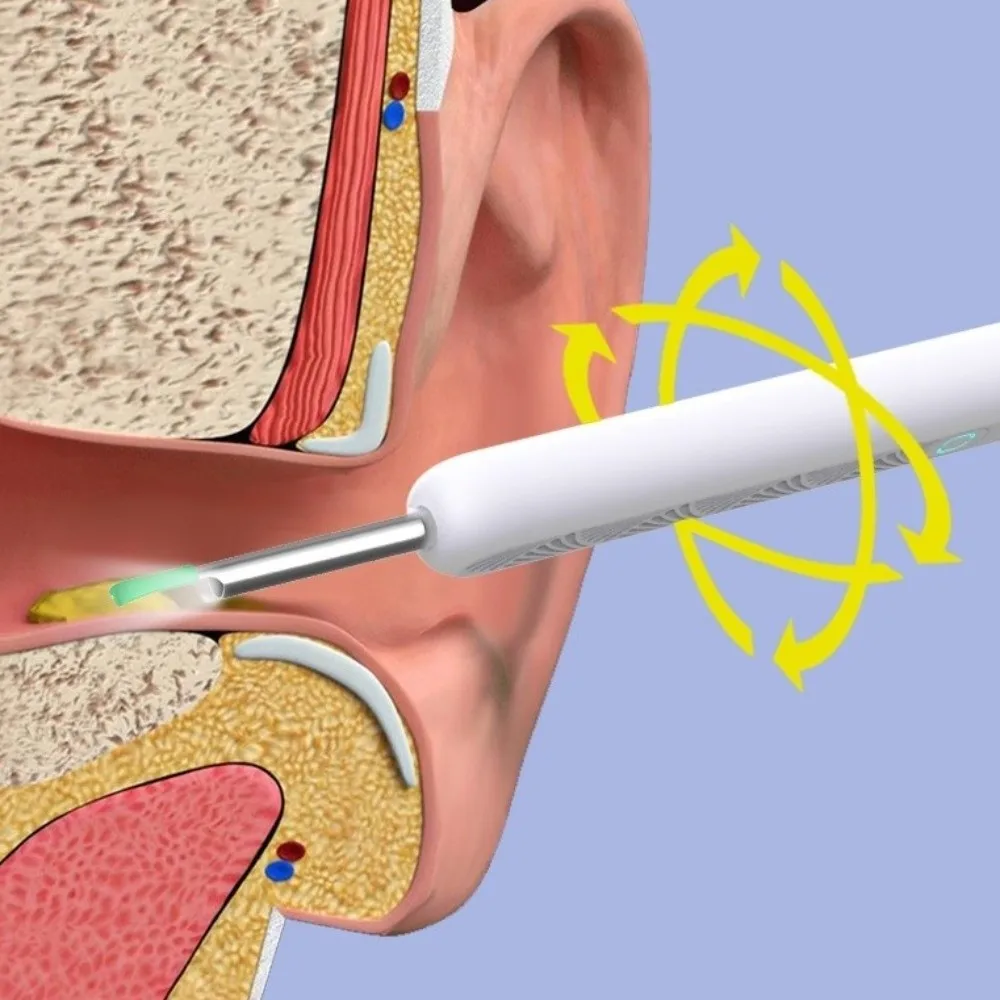 Smart Visual Ear Cleaner Wireless WiFi USB Charging Ear Cleaner Full Set HD Camera LED Lights Ear Wax Removal Tools Home Us