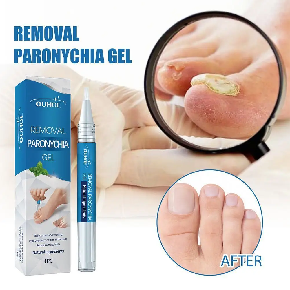 

Nail Fungal Repair Liquid Pen Onychomycosis Paronychia Fungus Infection Hand Gel Anti Serum Removal Fungus Foot Repair Nail I9J8