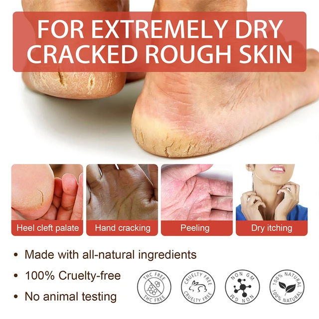 PediCare +K Technology Cracked Heel Repair Cream 30ml : Amazon.co.uk: Beauty