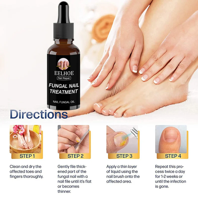 Сыворотка для восстановления ногтей nail fungal solution. Для восстановления ногтей на ногах. Ногтивит для размягчения ногтей на ногах. Для восстановления ногтей на ногах. От грибка ногтей дешевое средство.