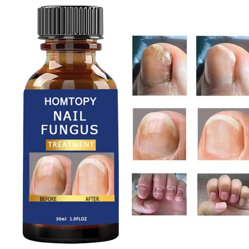 

Nail Hardener Nail Strengthener For Thin Nails And Growth Renewal Nail Repair Solution For Discolored And Damaged Nails