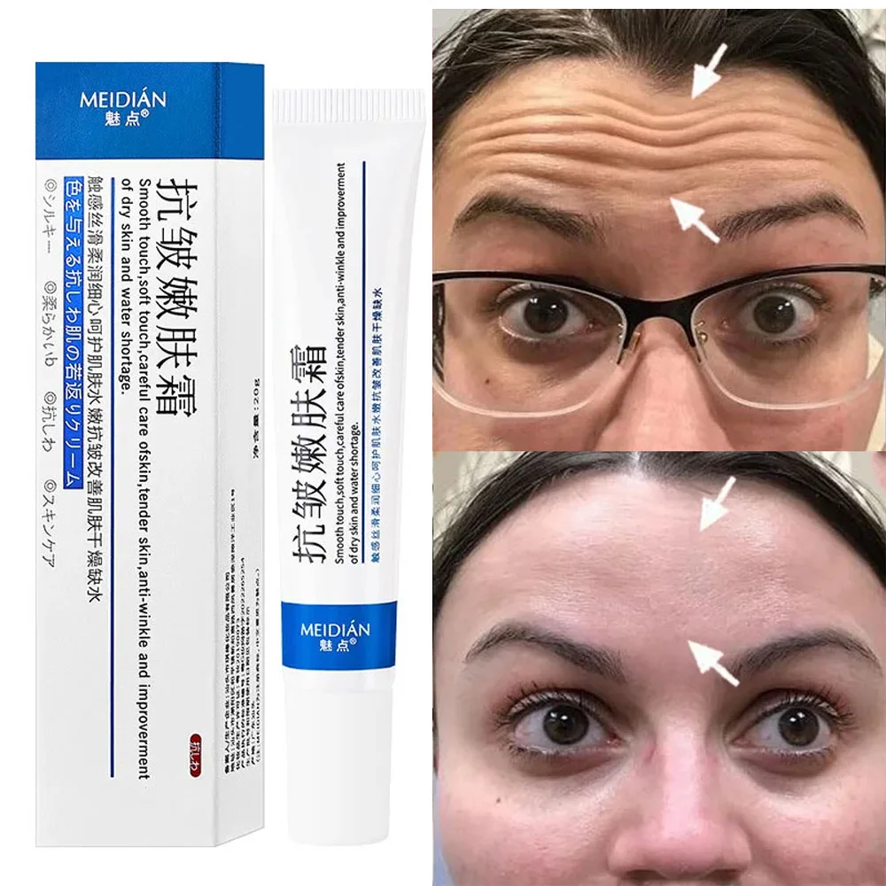 Retinol Wrinkle Removal Cream Instant Effect Anti-Aging Face Lift Firm Remove Nasolabial Wrinkle Fade Fine Line Korean Skin Care субстрат для орхидей effect ™ eco line 13 19 мм с цеолитом 2 л