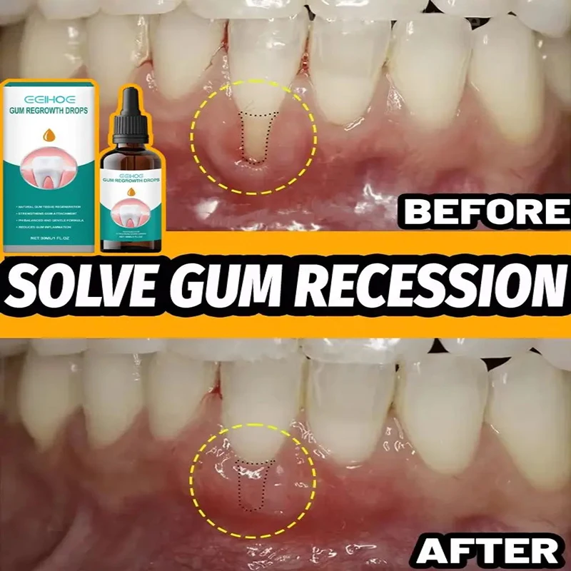 Whitening Teeth Essence teeth whitening product teeth whitening essence gum repair drops teeth health product effectively repair damaged gums Remove stains Clean teeth Oral dental care relieves swelling gums Expert