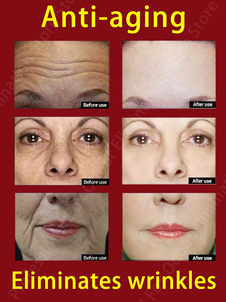 Anti-wrinkle Serum Remove Face Neck Forehead Wrinkles Anti-aging Skin Firming Products 3