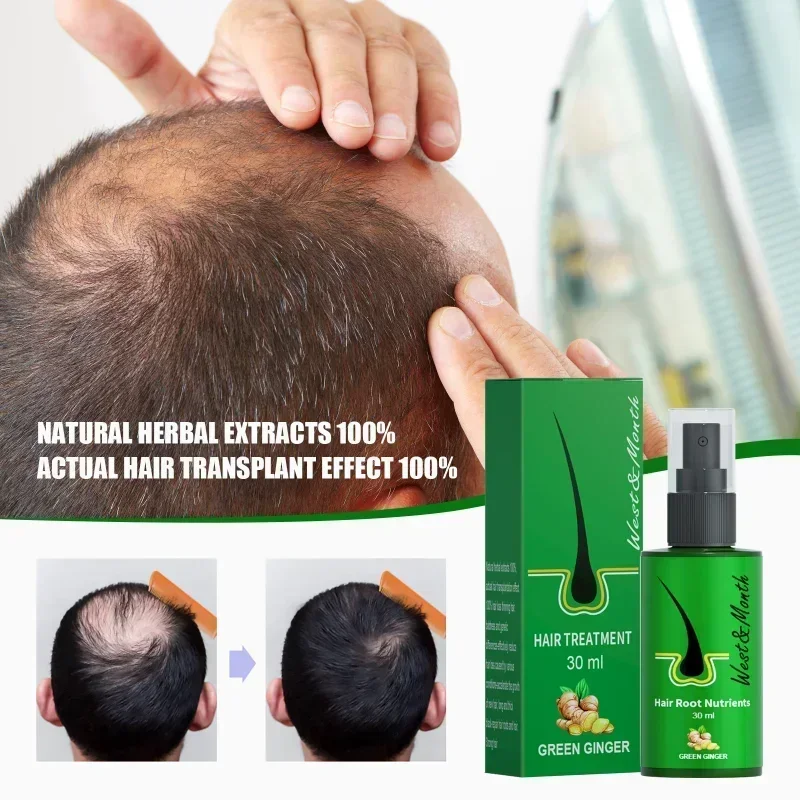 Herbal Hair Growth Products Men women Anti-alopecia Spray Care Scalp Treatment Prevent Hair Loss Essential Oil hair growth oil hair restoration products