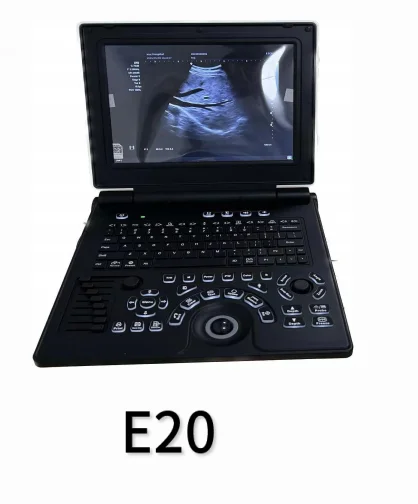 

Portable color ultrasound E20