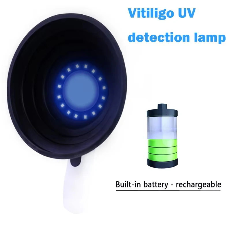 Cat Ringworm Detection Woods Lamp Skin Examination Skin Fungus Detector Vitiligo Pityriasis Versicolor Melasma Woods Light - Image 6