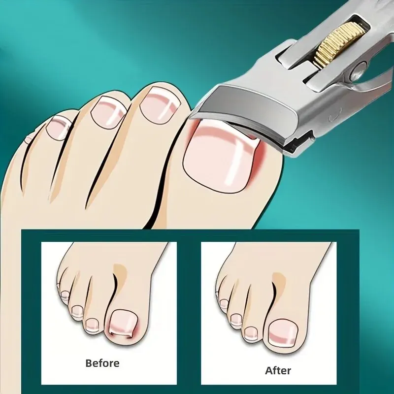 Nail Clipper Set Nail Care Kit Nail Scissors Set Nail Clippers Manicure Pedicure Kit Manicure Set Manicure Sets Manicure Nail Clipper Set Nail Clippers Kit New Nail Clippers With Nail File Set Safety Gear Lock Toenail Clippers For Thick Nails Heavy Duty Fingernail Cutter