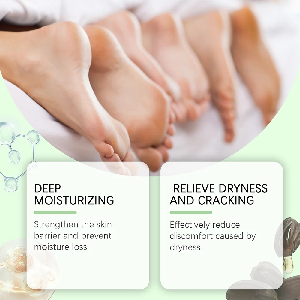 8.8oz 40% Urea Foot Hand Care Cream Used for Heel Care, Deeply Moisturizing and Nourishing Your Dry Rough Skin foot cream