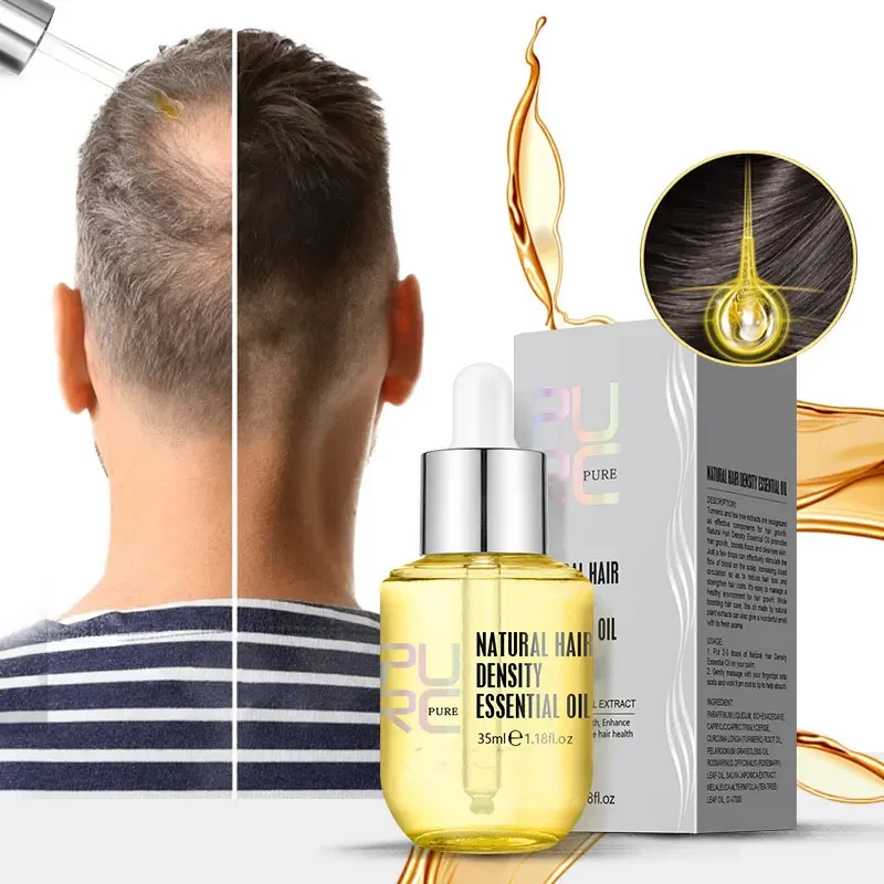 

Средство для роста волос PURC Ginger Essentials, спреи для мужчин и женщин, искусственное масло, мужские искусственные волосы, красота, здоровье