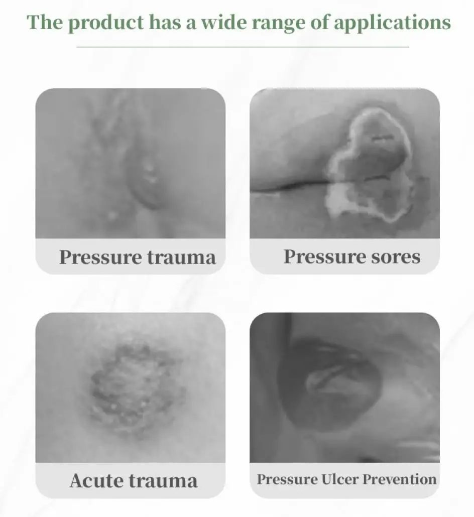 Description Picture 3 of item5 Sizes of Bordered Adhesive Dressing Pad Waterproof Silicone Gel Dressings for Bedsores Sacrococcygeal Buttock Wound