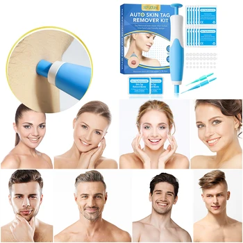 2 IN 1 Auto Micro Skin Tag Remover Device Standard And Micro Skin Tag Removal Kit Adult Mole Wart Remover Face Care Beauty Tools 4