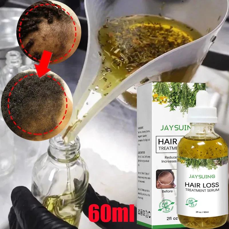 New Fast Hair Growth Serum 100% African Crazy Traction Alopecia Anti Hair Loss Essential Prevents Bald Thinnin Hair Care Oil