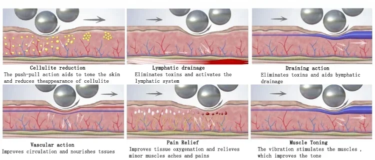 <h3 class="features--headline">Features and benefits</h3> <ul> <li><strong>High-Performance Cellulite Removal</strong>: Effectively smooths out uneven skin and visibly diminishes the appearance of cellulite, leaving clients with a toned and contoured silhouette.</li> <li><strong>Multi-Level Intensity Settings</strong>: Customizable to cater to various skin types and treatment areas, from gentle facial massages to deep-tissue body sculpting.</li> <li><strong>Enhanced Lymphatic Drainage</strong>: Promotes natural detoxification by improving circulation and boosting metabolic activity, reducing fluid retention and bloating.</li> <li><strong>Relaxing, Painless Treatment</strong>: Combines therapeutic massage with cutting-edge technology to deliver a soothing experience that feels indulgent yet transformative.</li> </ul> <hr /> <span class="tw-text-2xl tw-font-bold" style="color: #99ccff;">1 YEAR WARRANTY + 3 YEAR TECH SUPPORT</span> <span class="tw-text-2xl tw-font-bold" style="color: #99ccff;">30 DAY MONEY-BACK AND <a href="https://salonmachines.com/refund_returns/">RETURN POLICY</a></span> <span class="tw-text-2xl tw-font-bold" style="color: #99ccff;">FREE WORLDWIDE SHIPPING <a href="https://salonmachines.com/shipping-policy/">SHIPPING POLICY</a></span> <span class="tw-text-2xl tw-font-bold" style="color: #99ccff;">PROFESSIONAL BEAUTY <a href="https://salonmachines.com/">SALON MACHINES</a> EQUIPMENT</span> Best Endosphere Machine Inner Ball Roller Massagers
