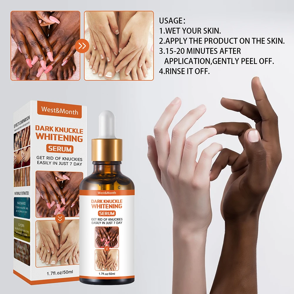 50 ml Aufhellungsserum, 7-Tage-Entferner, beseitigt dunkle Knie, dunkle Knöchel, Ellenbogen, Creme, Nikotinamid, hellt den Hautton auf. 2023 Neu_voghion.com