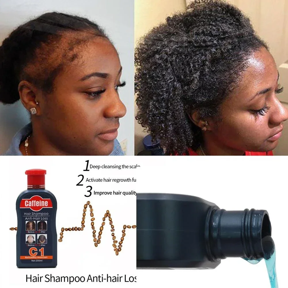 2 Month Super Fast Hair Growth Shampoo Combining Africa Chad Chebe Powder Local Ingredients with Modern Craftsmanship 200ml