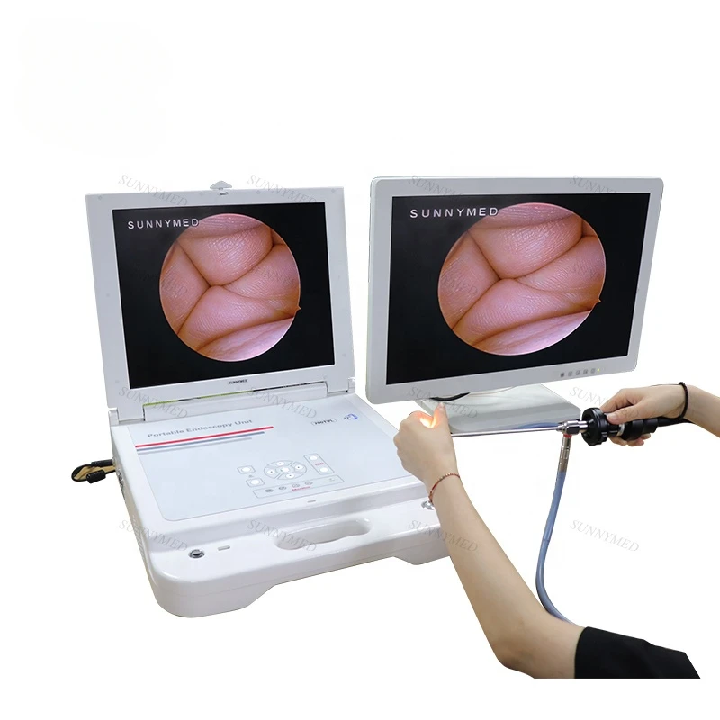 

SY-PS045N Medical ENT Endoscope CCD Endoscope Camera With LED Light Source Integrated Endoscopy Camera