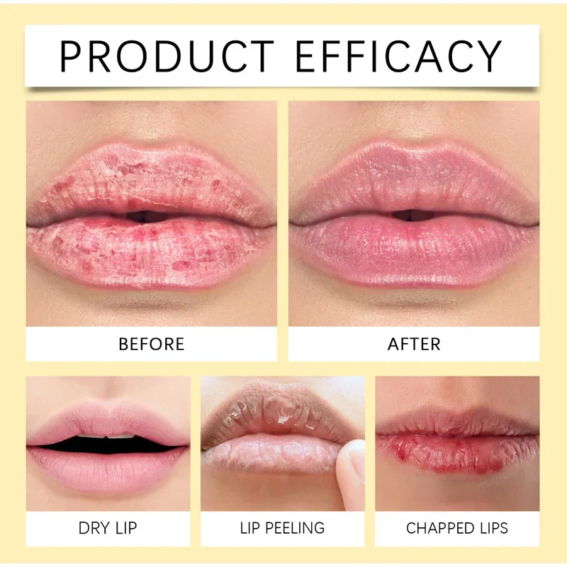 Remove Dark Lip Balm Lightening Melanin Mask Gloss Oil Exfoliating Clean Deep Moisturizing Makeup Korean Beauty Care Products