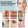 60Pcs Gold Protein Line Fade Wrinkle Firming Facial Filler No Needle Absorbable Smoothing Hydrolyzed Collagen Thread Serum 4