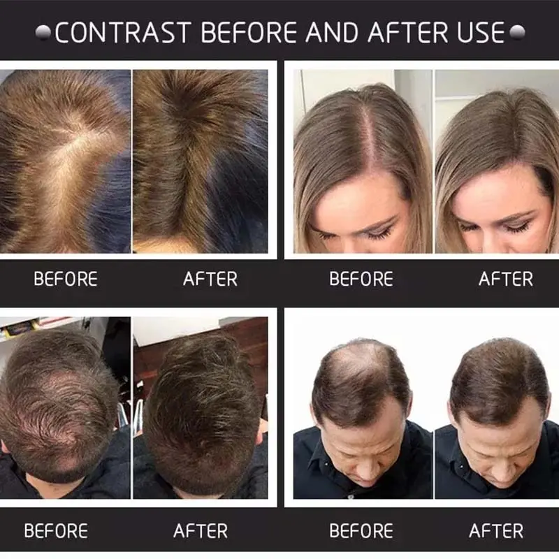 Volume Thickening Hair Fiber Spray Head Comb Hair Powder 3 Piece Hairline Powder Pretty Wig Spray Natural Volume Light Odorless