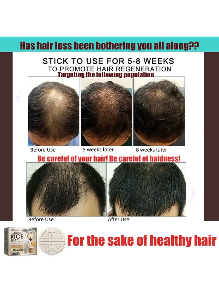 Used as shampoo.Nourishing, Firming,Anti Dropping,Protecting the scalp.Protecting the scalp and Nourishing Hair Roots