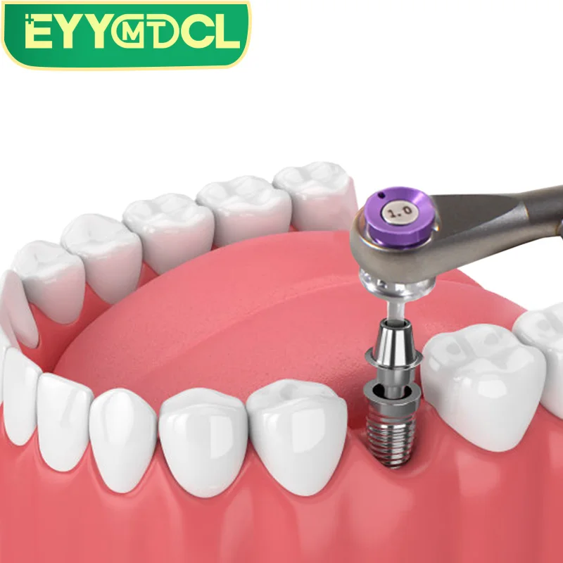 치과 재료 치과 임플란트 토크 렌치 스크루 드라이버 도구 10-70NCM Endodontics 올인원 심기 16 PCS 임상