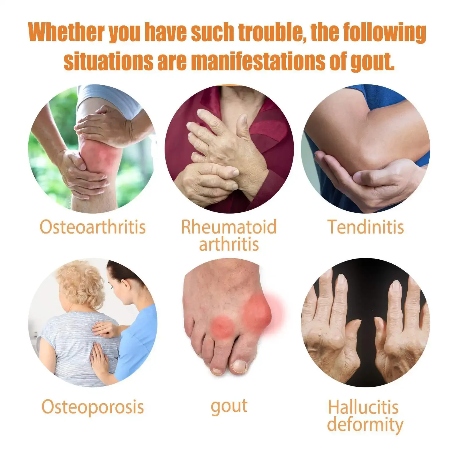 Pain Relief Cream Bee Venom Arthritis Spray Anti-Inflammatory Bone Therapy Muscle Ache Relief Treat Meniscus Sprain Medical Joint Analgesic Spray
