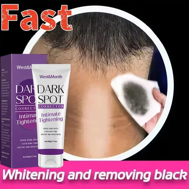 Body Whitening Lotion Dark Spot Remover For Underarms Knees Elbows Melanin Bleaching Lightening Skin Moisturizing Cream 60g