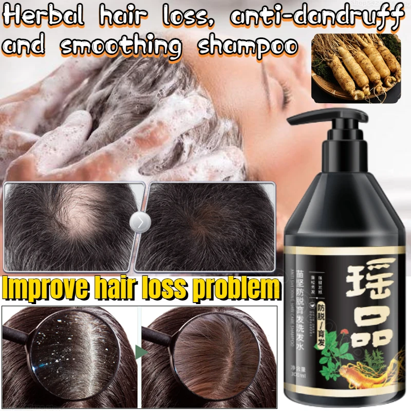 

Yao Pin Anti-Shedding Shampoo Herbal Shampoo Improve White Hair Loss Anti-Dandruff Anti-Itch Oil Control Support 300ml