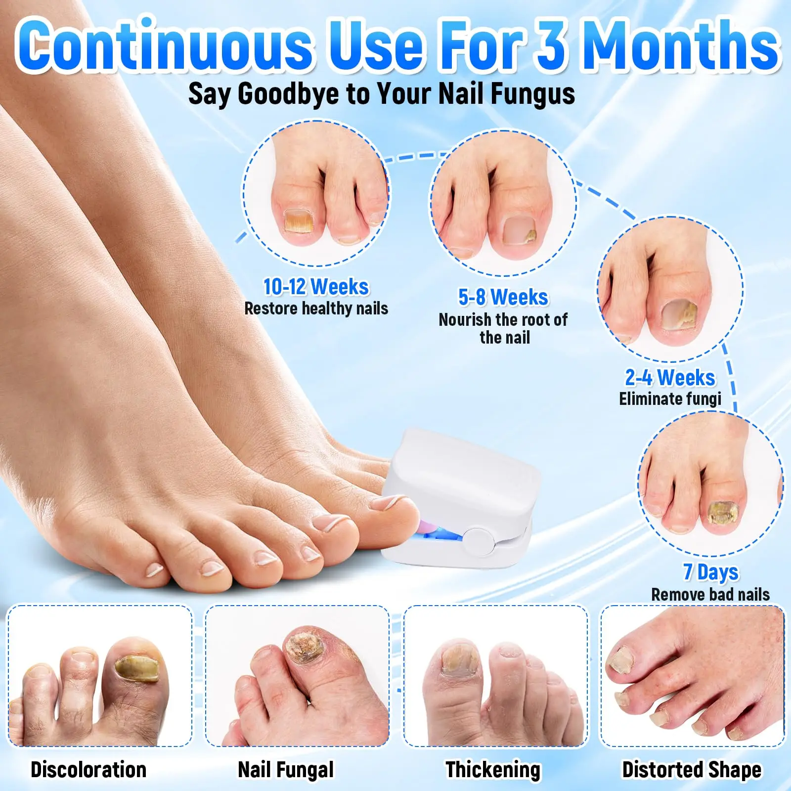 Nail Cleaner Laser Device Effective Serum Nail Correction Recover Oil Pain Reliever Softener Repair Foot Care