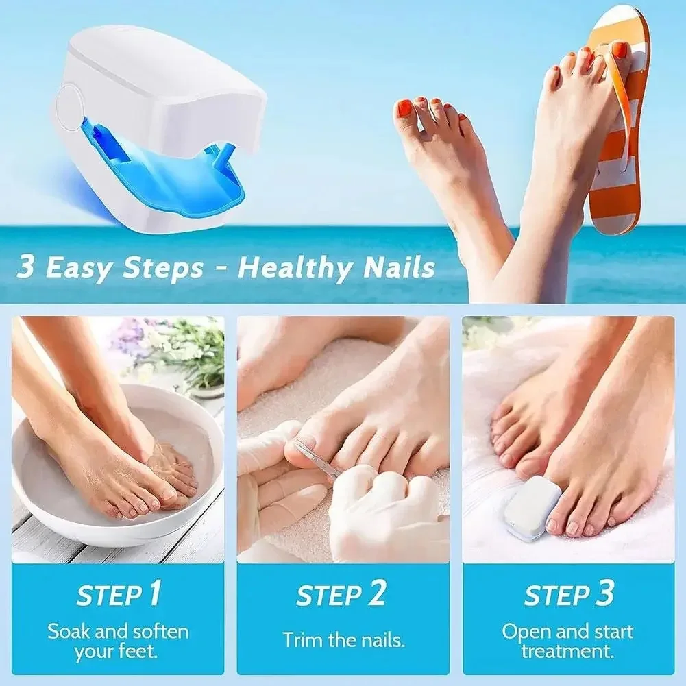 USB rechargeable portable UV remove nail fungus lamp portable auxiliary tool UV Disinfection and killingnail fungus mini lamp